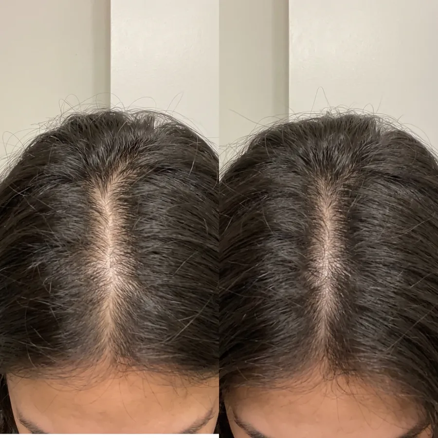 Prescribed Essence | Hair part comparison illustration AI-generated comparison illustration